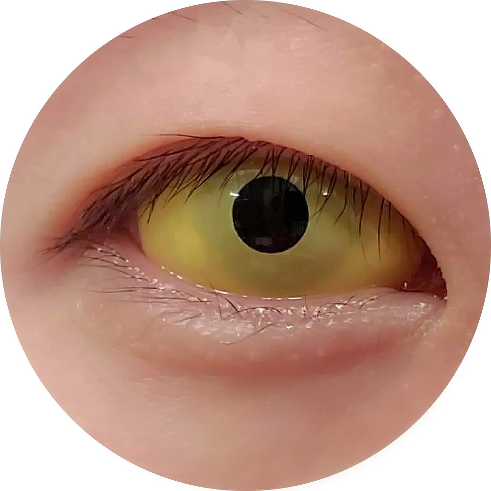 Sweety Yellow Sclera Contacts (1 lens/pack)